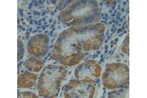 Used in DAB staining on fromalin fixed paraffin- embedded Kidney tissue