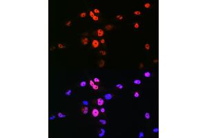 Immunofluorescence analysis of RD cells using MyoD1 Rabbit pAb (ABIN7268736) at dilution of 1:100 (40x lens). (MYOD1 anticorps  (AA 150-250))