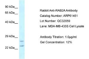 Western Blotting (WB) image for anti-RAB2A, Member RAS Oncogene Family (RAB2A) (C-Term) antibody (ABIN2774315) (RAB2A anticorps  (C-Term))