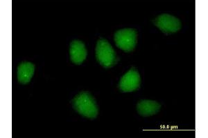 Immunofluorescence of purified MaxPab rabbit antibody to NR3C1 on HeLa cell. (Glucocorticoid Receptor anticorps  (AA 1-777))