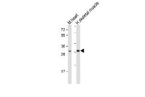 All lanes : Anti-DIO2 Antibody (Center) at 1:500-2000 dilution Lane 1: Mouse heart tissue lysate Lane 2: Human skeletal muscle tissue lysate Lysates/proteins at 20 μg per lane.