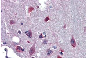 Human Brain, Cortex (formalin-fixed, paraffin-embedded) stained with NR2E1 antibody ABIN462191 followed by biotinylated goat anti-rabbit IgG secondary antibody ABIN481713, alkaline phosphatase-streptavidin and chromogen.