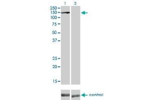 Western blot analysis of BUB1B over-expressed 293 cell line, cotransfected with BUB1B Validated Chimera RNAi (Lane 2) or non-transfected control (Lane 1).
