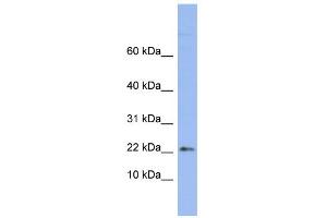 WB Suggested Anti-RPS24 Antibody Titration:  0. (RPS24 anticorps  (Middle Region))