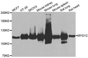 Western blot analysis of extracts of various cell lines, using MYO1C antibody. (Myosin IC anticorps  (AA 769-1028))