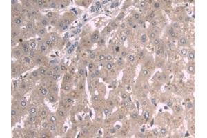 Detection of APOA1 in Human Kidney Tissue using Monoclonal Antibody to Apolipoprotein A1 (APOA1)