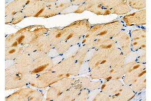ABIN6257114 and ABIN6274151 at 1/100 staining Rat skin tissue by IHC-P. (CKM anticorps  (N-Term))
