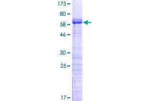 Image no. 1 for Melanoma Antigen Family B, 2 (MAGEB2) (AA 1-319) protein (GST tag) (ABIN1310063)