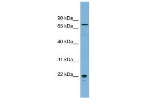 WB Suggested Anti-MPP5 Antibody Titration:  0. (MPP5 anticorps  (Middle Region))