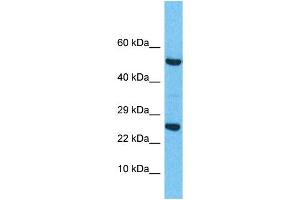 Western Blotting (WB) image for anti-Related RAS Viral (R-Ras) Oncogene Homolog 2 (RRAS2) (C-Term) antibody (ABIN2785767) (RRAS2 anticorps  (C-Term))