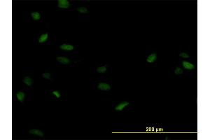 Immunofluorescence of monoclonal antibody to POLA2 on HeLa cell. (POLA2 anticorps  (AA 1-598))