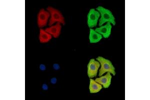 ABIN7097063 and ABIN7101130 staining Hela cells by IF/ICC. (FAM161B anticorps)