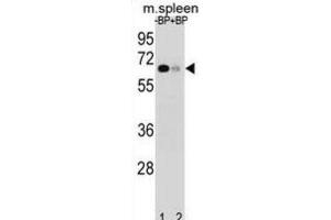 Western Blotting (WB) image for anti-Ankyrin Repeat and SOCS Box-Containing 3 (ASB3) antibody (ABIN2998967) (ASB3 anticorps)
