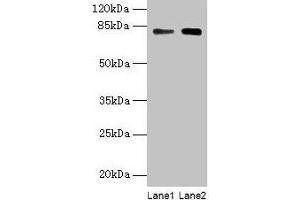 Western blot All lanes: MASP1 antibody at 6 μg/mL Lane 1: Hela whole cell lysate Lane 2: U251 whole cell lysate Secondary Goat polyclonal to rabbit IgG at 1/10000 dilution Predicted band size: 80, 82, 44, 69 kDa Observed band size: 80 kDa (MASP1 anticorps  (AA 20-699))