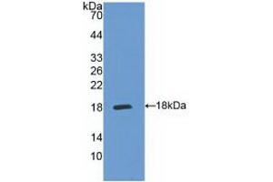 Western blot analysis of recombinant Human IL5Ra. (IL5RA anticorps  (AA 42-182))