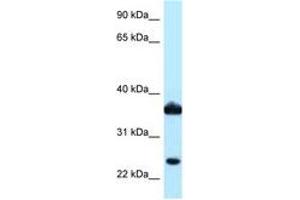 Image no. 1 for anti-Aldo-Keto Reductase Family 1, Member C3 (3-alpha Hydroxysteroid Dehydrogenase, Type II) (AKR1C3) (AA 97-146) antibody (ABIN6747883) (AKR1C3 anticorps  (AA 97-146))