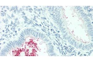 Immunohistochemistry of paraffin-embedded Human Uterus tissue using SLC34A2 Polyclonal Antibody at dilution of 1:60. (SLC34A2 anticorps)