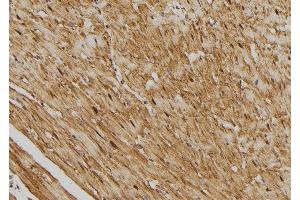 ABIN6275415 at 1/100 staining Rat heart tissue by IHC-P.