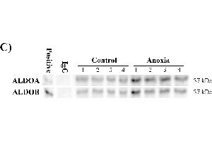 Aldolase purification and expression from the liver of control and anoxic turtles.