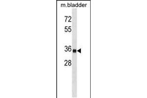 Western blot analysis in mouse bladder tissue lysates (35ug/lane).