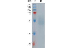 Human R Protein, hFc Tag on SDS-PAGE under reducing condition.