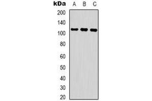 Western blot analysis of COP1 (pS387) expression in Jurkat UV-treated (A), 293 UV-treated (B), K562 UV-treated (C) whole cell lysates. (RFWD2 anticorps  (pSer387))