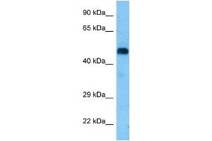 Host:  Rat  Target Name:  RIPK3  Sample Tissue:  Rat Brain  Antibody Dilution:  1ug/ml (RIPK3 anticorps  (Middle Region))