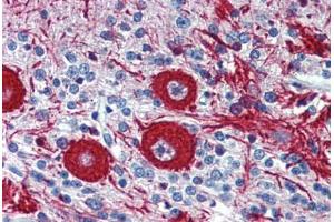 Human Brain, cerebellum: Formalin-Fixed, Paraffin-Embedded (FFPE)