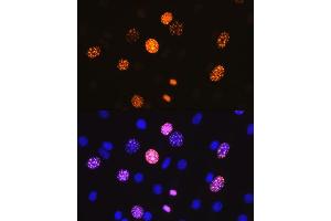 Immunofluorescence analysis of NIH-3T3 cells using Phospho-Histone H3-S10 antibody (ABIN3019419, ABIN3019420, ABIN3019421, ABIN1681355 and ABIN7101861).