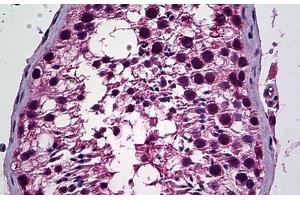 Human Testis: Formalin-Fixed, Paraffin-Embedded (FFPE) (PREX1 anticorps  (AA 1514-1526))