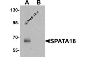 Western Blotting (WB) image for anti-Spermatogenesis Associated 18 (SPATA18) (N-Term) antibody (ABIN1031583) (SPATA18 anticorps  (N-Term))