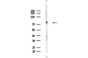 anti-Ribosomal Protein S6 Kinase, 90kDa, Polypeptide 3 (RPS6KA3) (pSer386) antibody