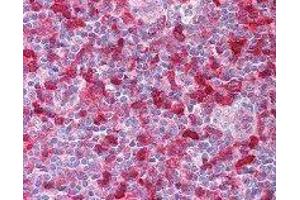 Immunohistochemistry (IHC) image for anti-Spleen tyrosine Kinase (SYK) (AA 5-360) antibody (ABIN2665374)