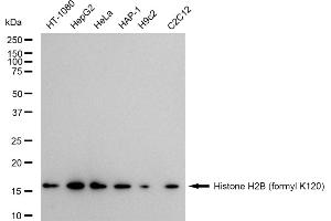Western blotting analysis using Histone H2B (formyl K120) antibody (ABIN7798948).