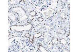 ABIN6266711 at 1/100 staining human kidney tissue sections by IHC-P. (AKAP8 anticorps  (Internal Region))