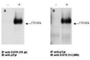 Combined immunoprecipitation and western blot using anti-EGFR antibody. (EGFR anticorps)