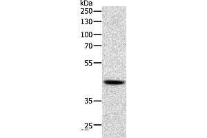 Western blot analysis of Human lymphoma tissue, using SOX7 Polyclonal Antibody at dilution of 1:750 (SOX7 anticorps)