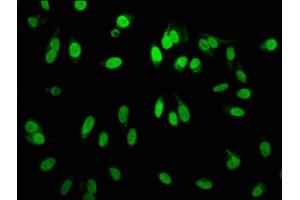 Immunofluorescence staining of Hela cells with ABIN7127304 at 1:60,counter-stained with DAPI.