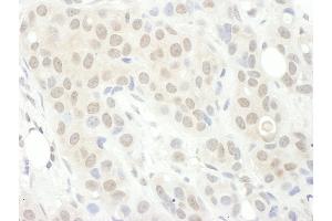 Immunohistochemistry (IHC) image for anti-Protein Phosphatase 2, Regulatory Subunit B', gamma (PPP2R5C) (AA 490-524) antibody (ABIN7454962)