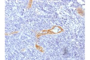 Formalin-fixed, paraffin-embedded human Tonsil stained with vWF Recombinant Mouse Monoclonal Antibody (rVWF/1465).