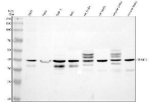 Western blot analysis of TRIM13 using anti-TRIM13 antibody (ABIN7825980).