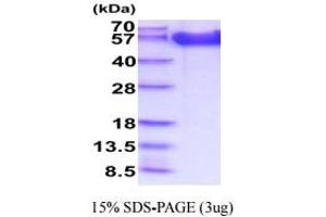 SDS-PAGE (SDS) image for Fibroblast Growth Factor Receptor 1 (FGFR1) (AA 22-376) protein (His tag) (ABIN5854969)