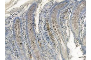 ABIN6255832 and ABIN6267103 at 1/100 staining human normal colon tissue by IHC-P. (CD79a anticorps  (pTyr182))