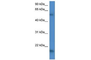 WB Suggested Anti-GPT2 Antibody Titration:  0. (GPT2 anticorps  (C-Term))
