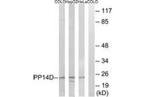 Western Blotting (WB) image for anti-Protein Phosphatase 1, Regulatory (Inhibitor) Subunit 14D (PPP1R14D) (AA 66-115) antibody (ABIN2890541) (PPP1R14D anticorps  (AA 66-115))