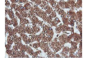 Immunohistochemical staining of paraffin-embedded Human liver tissue using anti-PDIA4 mouse monoclonal antibody. (PDIA4 anticorps)