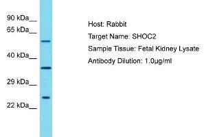 Host: Rabbit Target Name: SHOC2 Sample Tissue: Human Fetal Kidney Antibody Dilution: 1ug/ml (SHoc2/Sur8 anticorps  (N-Term))