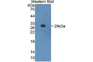 Figure. (CBFB anticorps  (AA 1-187))