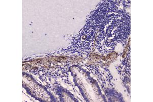 IHC analysis of MYLK using anti-MYLK antibody . (MYLK anticorps  (AA 1441-1709))