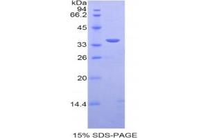 SDS-PAGE analysis of Human PST Protein. (SULT1A1 Protéine)